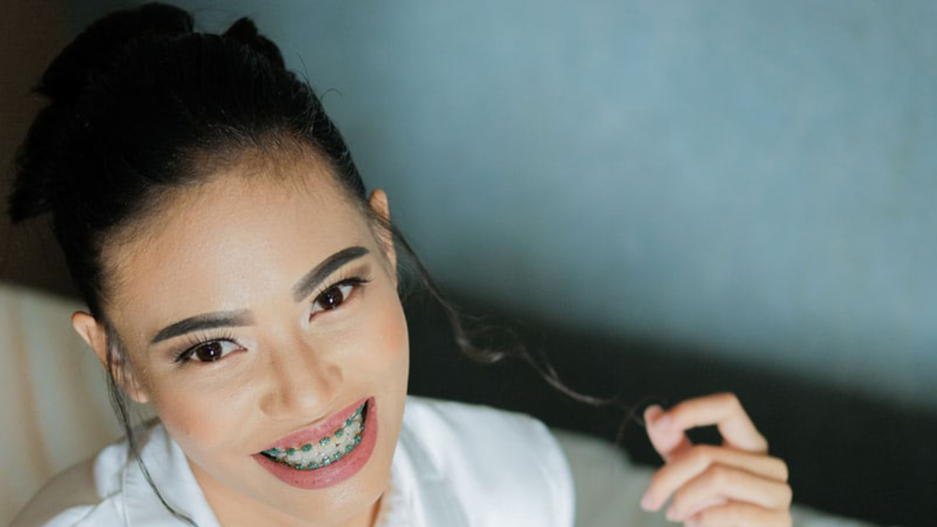 Why Braces are Worth Every Penny