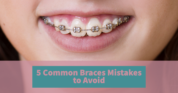5 Common Braces Mistakes to Avoid