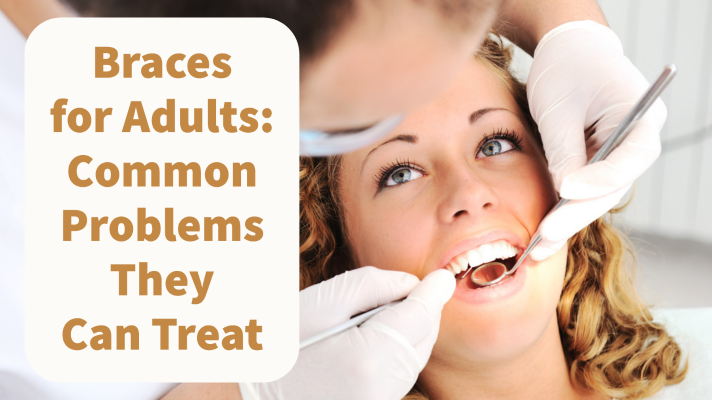 Braces for Adults: Common Problems They Can Treat