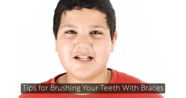 Tips for Brushing Your Teeth With Braces