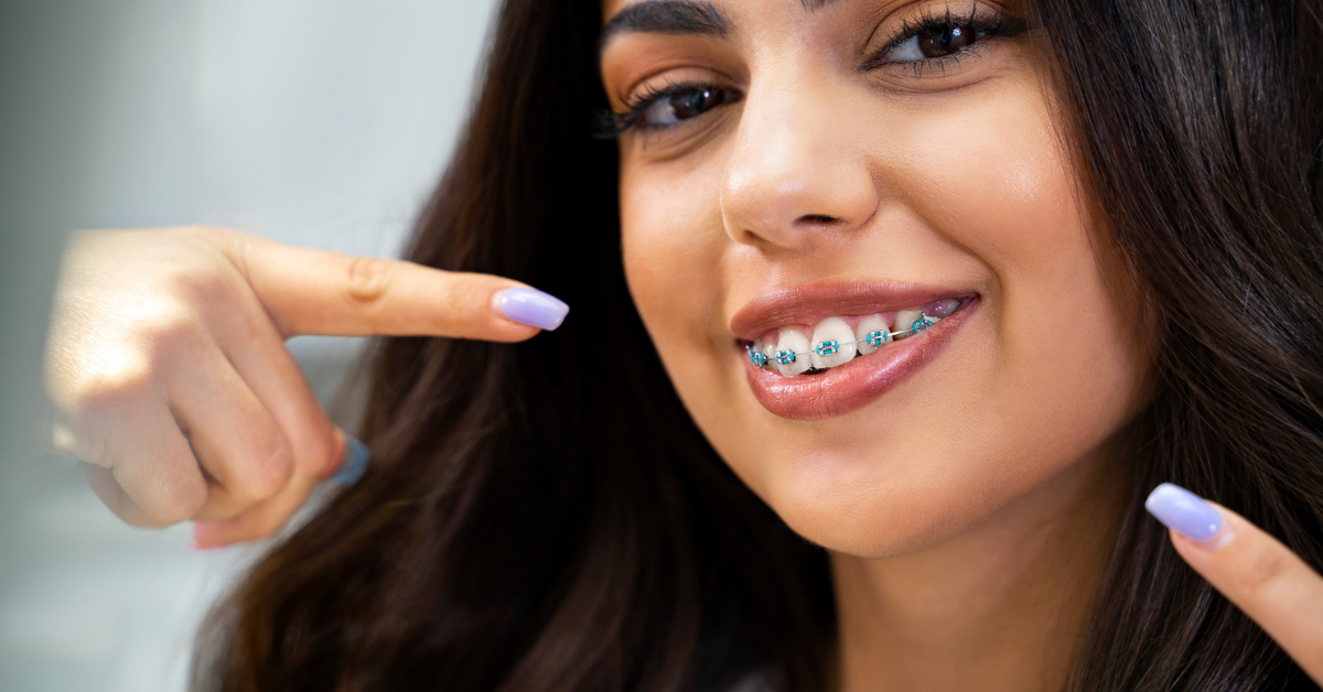 Do Braces Hurt? What to Expect During Treatment at Smiley Face Braces in Jacksonville, FL